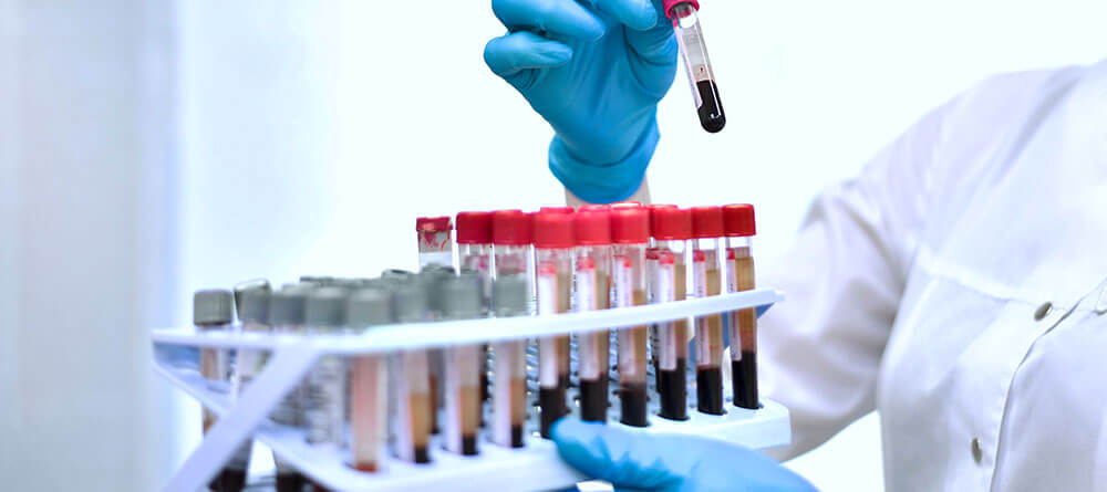 A medical researcher handles blood samples in a laboratory setting