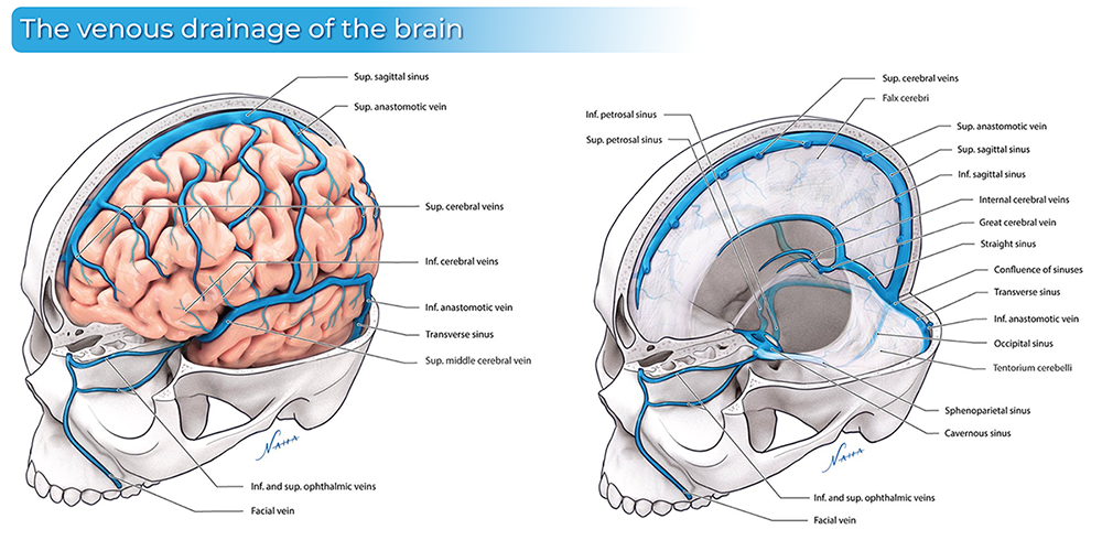 Illustrations that were created by extracting a skull and brain from an MRI/CT