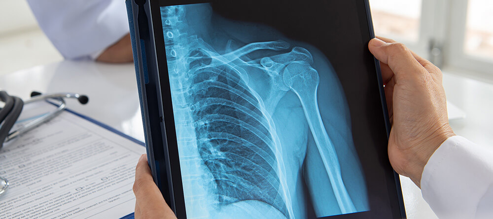 Dr Examining X-Ray
